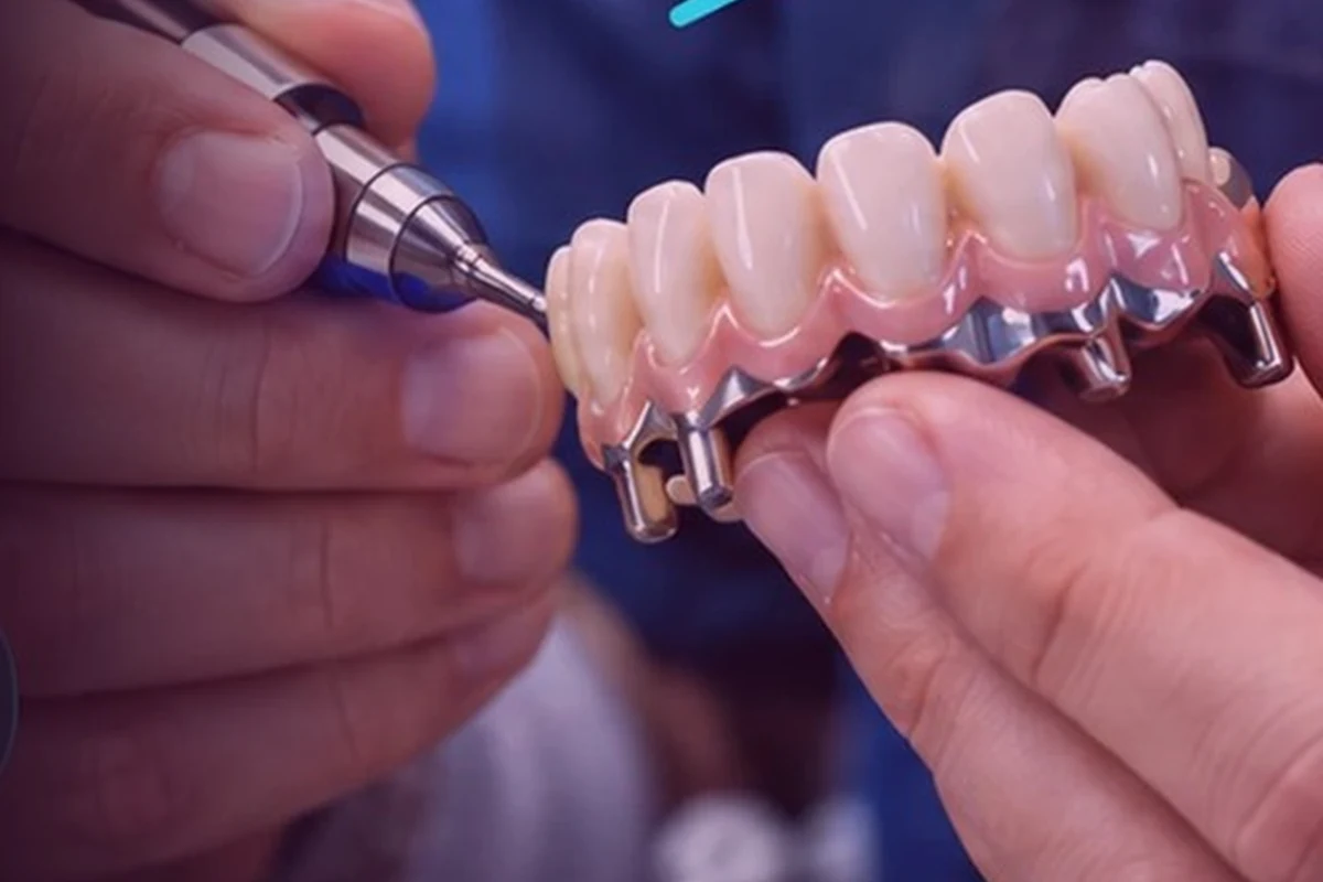 Manos trabajando sobre una prótesis dental.